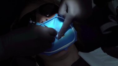 Diş hekimi diş kliniği kadın hastada tedavi. Kadın profesyonel doktor stomatologist iş başında. Diş işaretleyiniz