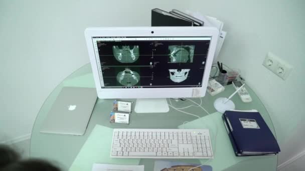 SAINT-PETERSBURG, RUSIA - 30 AUGUST 2018: O radiografie pe monitor la clinica stomatologica — Videoclip de stoc