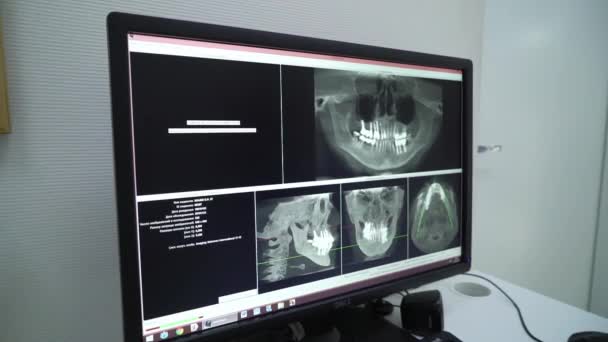 MOSCÚ, RUSIA - 25 DE NOVIEMBRE DE 2018: Gabinete médico de rayos X en el hospital. Lugar de trabajo del médico en la clínica . — Vídeos de Stock