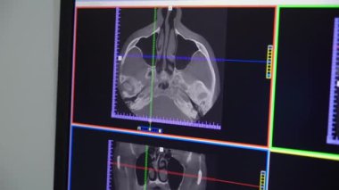 Moskova, Rusya - 25 Kasım 2018: Hastane X-ray tıbbi dolapta. İş yerinde bir doktor Kliniği.