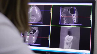 Moskova, Rusya - 25 Kasım 2018: Hastane X-ray tıbbi dolapta. İş yerinde bir doktor Kliniği.