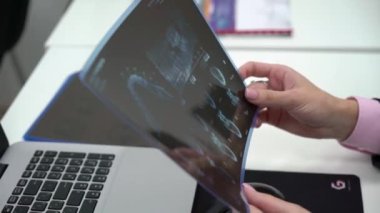 Moskova, Rusya - 25 Kasım 2018: Diş ve çene röntgen filmi holding tıp öğrencisi doktor.