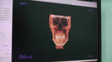 Moskova, Rusya - 25 Kasım 2018: Hastane X-ray tıbbi dolapta. İş yerinde bir doktor Kliniği.