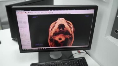 Moskova, Rusya - 25 Kasım 2018: Hastane X-ray tıbbi dolapta. İş yerinde bir doktor Kliniği.