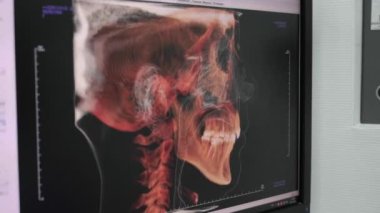 Moskova, Rusya - 25 Kasım 2018: Hastane X-ray tıbbi dolapta. İş yerinde bir doktor Kliniği.