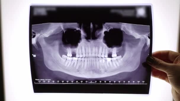 Filme de raios-X de dentes e mandíbula . — Vídeo de Stock
