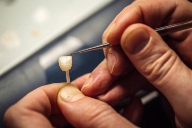 diş hekimi diş laboratuvarında diş tacı üzerinde çalışır. tıbbi kavram.