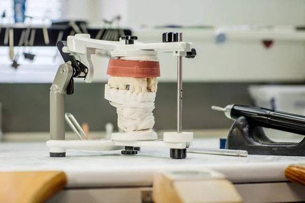 Prototypes of false teeth, creation of teeth, devices of prosthetics