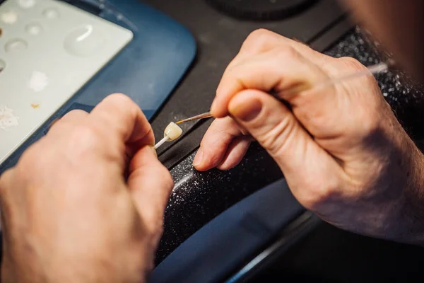 Dentista Lavora Sulla Corona Dei Denti Laboratorio Dentale Concetto Medico — Foto Stock