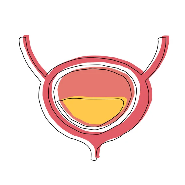 Vejiga urinaria humana dibujada a mano. Impresión superpuesta con offset. Vector de anatomía humana. Vector estilo mano libre . — Vector de stock