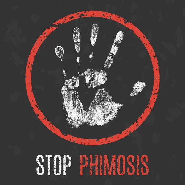 Conceptuele Vectorillustratie Medische Diagnose Stop Met Phimosis — Stockvector