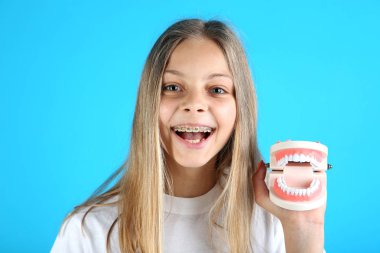 Mavi arka plan üzerinde diş diş telleri ve diş modeli ile genç gülümseyen kız