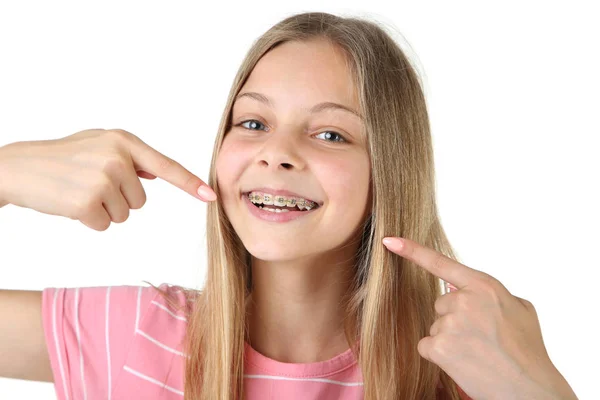 Leende Flicka Med Dental Hängslen Pekande Fingrar Tänder Vit Bakgrund — Stockfoto