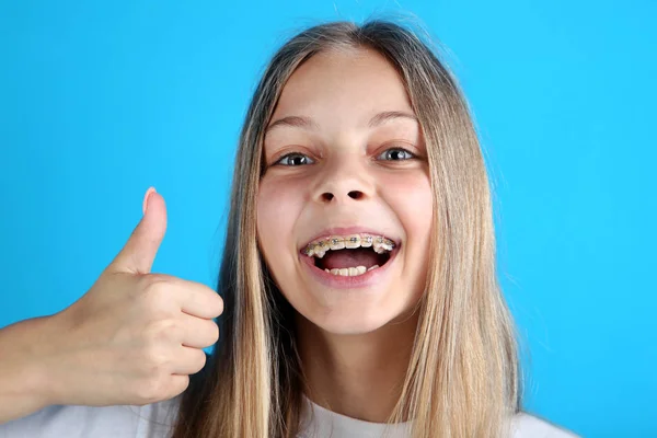 Lachende Meisje Met Tandheelkundige Accolades Camera Kijken Duim Opdagen Blauwe — Stockfoto