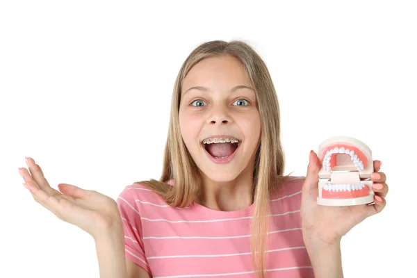 Young Smiling Girl Dental Braces Teeth Model Isolated White Background — Stock Photo, Image
