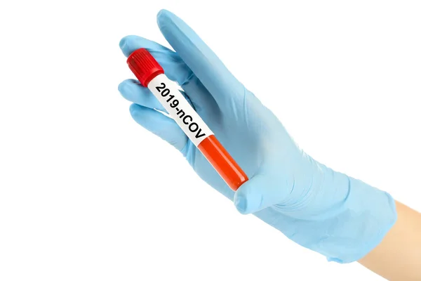 Coronavirus Konsepti Metin 2019 Ncov Test Tüpü Üzerinde Kadın Elinde — Stok fotoğraf