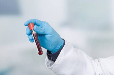 Doktor el kan sonda ile