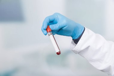 Doktor el bir kan sonda ile