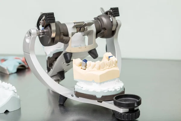 Sella Protesica Con Dentizione Artificiale Laboratorio Odontoiatrico — Foto Stock