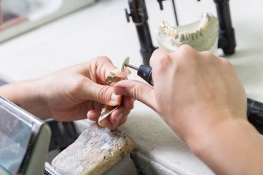 Diş crown diş laboratuvar çalışması