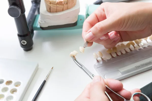 Tandtekniskt Laboratorium Använder Skugga Guide För Att Kontrollera Faner Tanden — Stockfoto