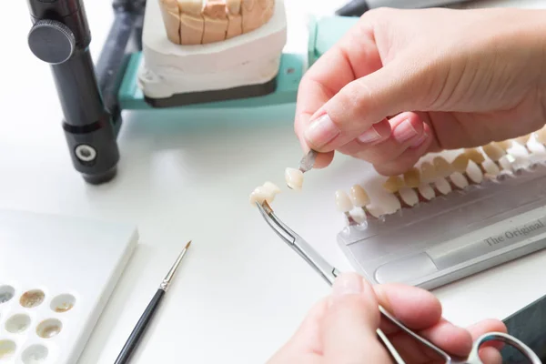 Laboratório Dentário Usando Guia Sombra Para Verificar Folheado Coroa Dente — Fotografia de Stock