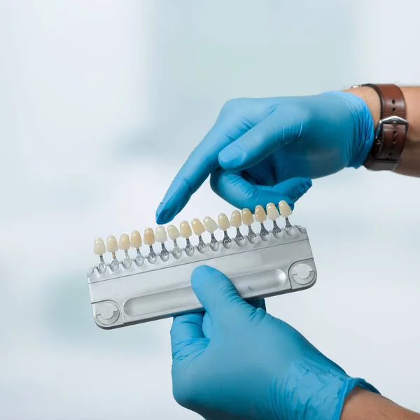 Dentist Hand Shows Shade Guide Check Veneer Tooth Crown Dental — Stock Photo, Image