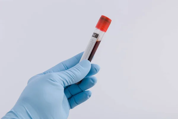 Doctors Hand Medical Glove Holds Blood Probe — Stock Photo, Image