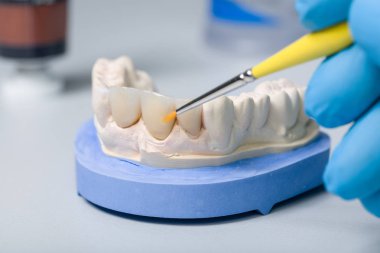 Yapay diş ve diş laboratuarında bir fırça ile diş Künye