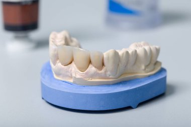 Yapay diş ve diş bir laboratuvar araçları ile diş Künye