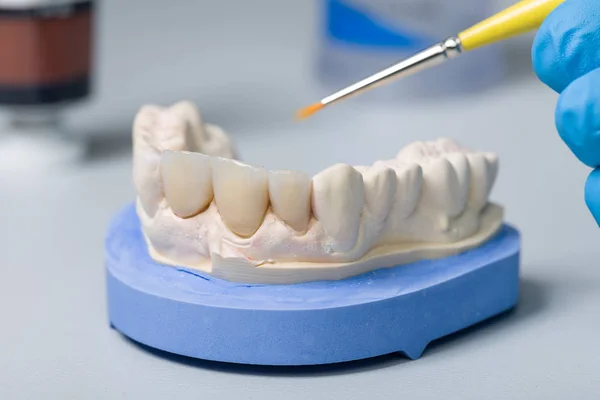 Bir Yapay Diş Diş Bir Laboratuvar Boyama — Stok fotoğraf