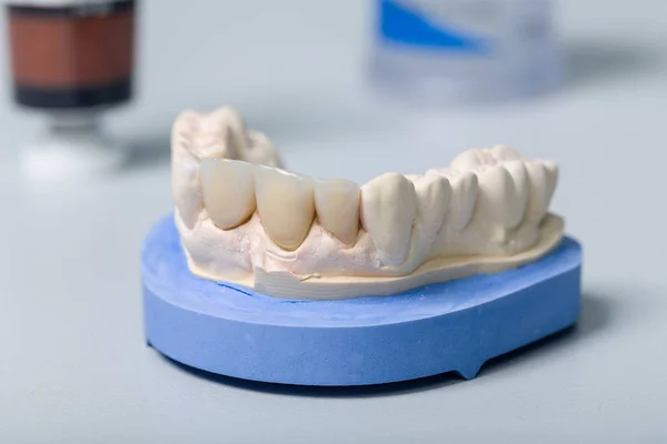 Dental Avtryck Med Konstgjorda Tanduppsättning Och Verktyg Ett Tandtekniskt Laboratorium — Stockfoto