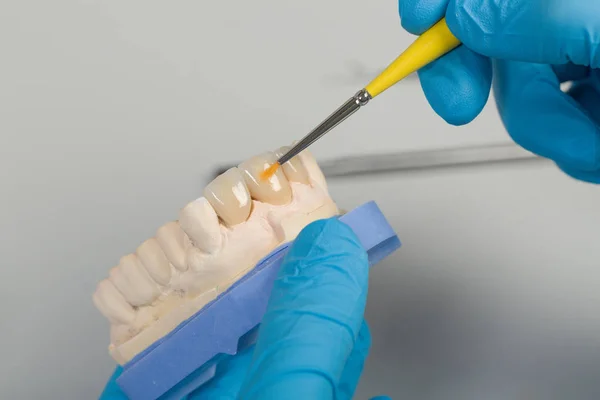 Dipingere Una Dentizione Artificiale Laboratorio Dentale — Foto Stock