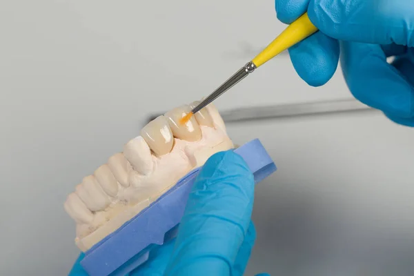 Bir yapay diş diş bir laboratuvar boyama