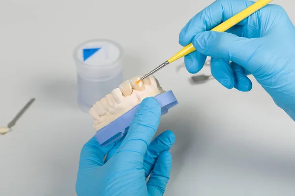 Pintura Impressão Dentária Com Dentição Artificial Num Laboratório Dentário — Fotografia de Stock