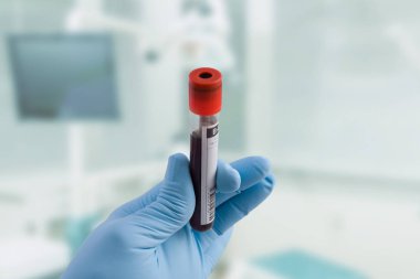 Doktor el Medikal eldiven ile bir kan sonda ve laboratuvar arka planda tutar