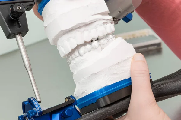 Lavorare Una Guida Dentaria Laboratorio Odontoiatrico — Foto Stock