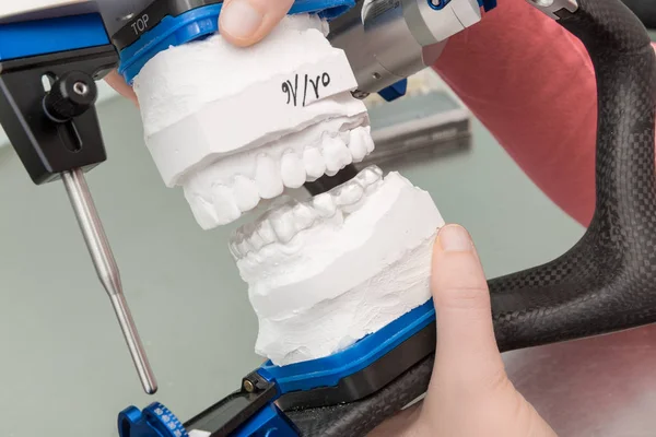Travailler Sur Rail Dentition Dans Laboratoire Dentaire — Photo