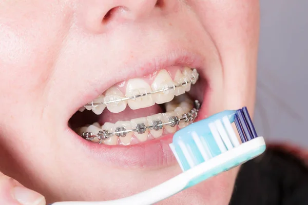 Mouth Woman Dental Brace Tooth Brush — Stock Photo, Image