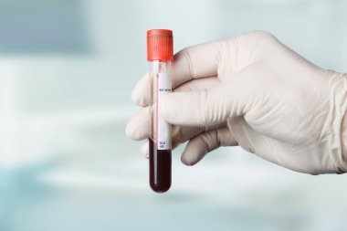 Doktor el medikal eldiven ile bir kan sonda tutar