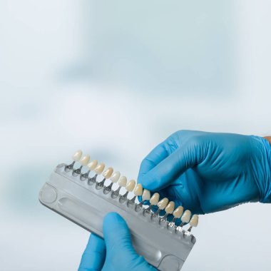 Diş hekimi el bir gölge Kılavuzu kaplama Diş Crown diş bir laboratuvar kontrol etmek için seçme