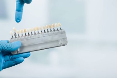 Diş hekimi el bir gölge Kılavuzu kaplama Diş Crown diş bir laboratuvar kontrol etmek için işaret ediyor