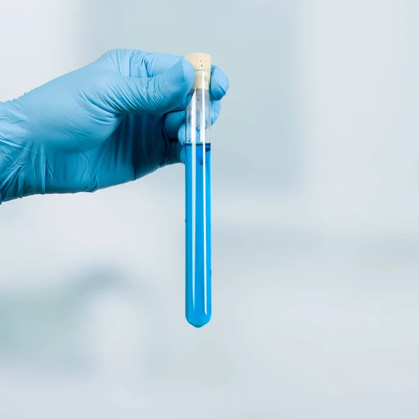 장갑에 손을 보유 실험실 배경 앞에서 파란 액체 테스트 튜브 — 스톡 사진