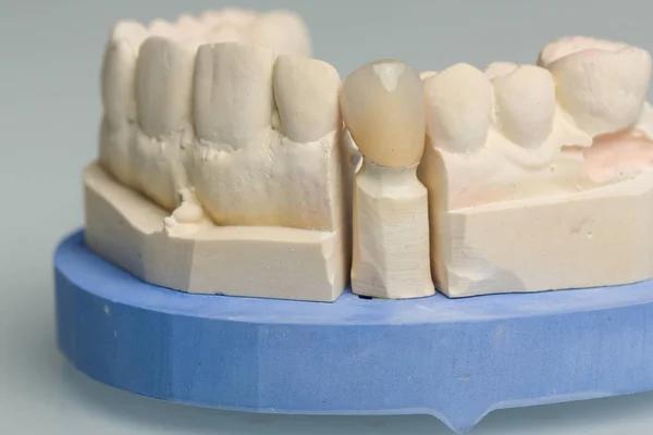 Dental laboratuvardaki suni dentiyle Dental baskı, kullanıma hazır