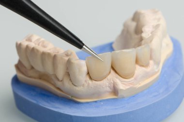 Diş laboratuarında protez üzerinde çalışma yakın