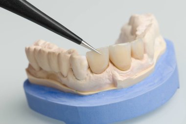 Diş laboratuarında protez üzerinde çalışma yakın