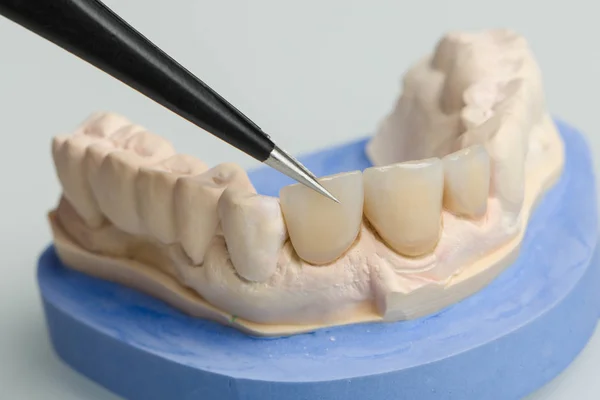 关闭牙科实验室义齿的工作 — 图库照片