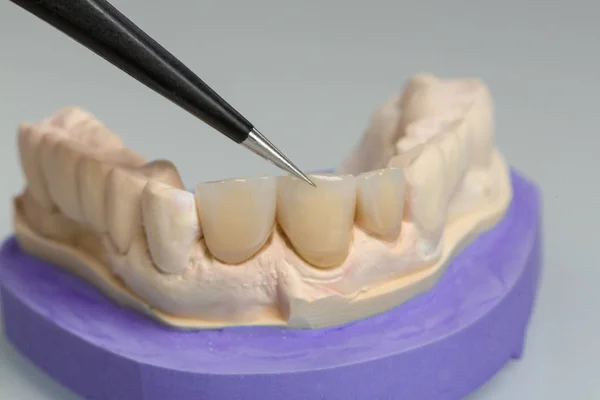 Diş Laboratuarında Protez Üzerinde Çalışma Yakın — Stok fotoğraf