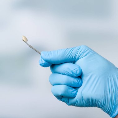 Diş kaplamakontrol etmek için gölge kılavuzu ile Diş hekimi eli 