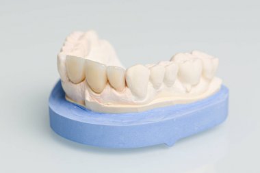 diş laboratuvarında protez parçalarının yakın çekimi